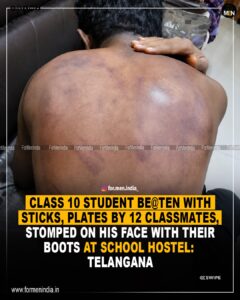 Read more about the article Class 10 student beaten with sticks, plates by 12 classmates, stomped on his face with their boots at school hostel : Telagana